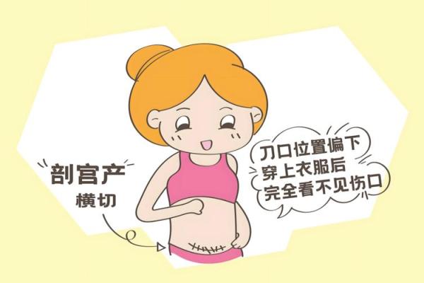 剖腹产选择吉日的步骤方法  给你的孩子一个更好