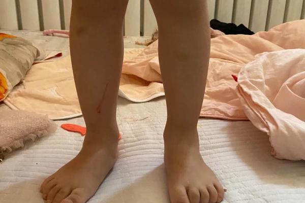 改外八字 改外八字