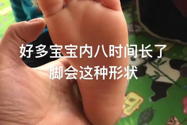 内八字脚 内八字脚