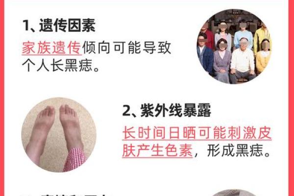 脚底的胎记算命分析 脚底的胎记算命分析
