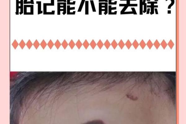 男婴眉心长“月牙”胎记,母亲带他算命后神秘失踪,至今下落不明 男婴眉心长“月牙”胎记,母亲带他算命后神秘失踪,至今下落不明
