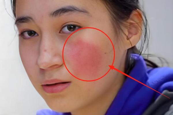 胎记位置算命看运势