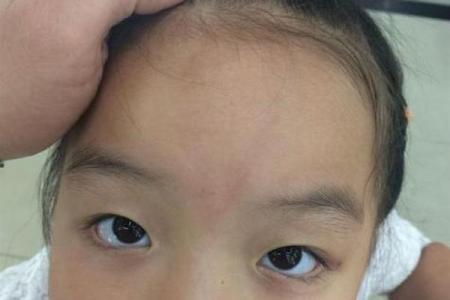 胎记位置算命看运势