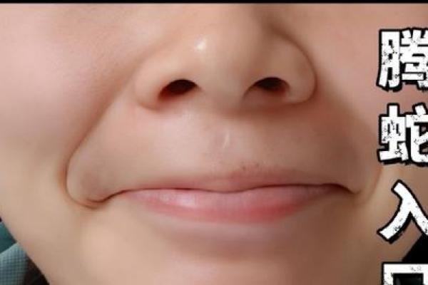 嘴巴八字纹 嘴巴八字纹