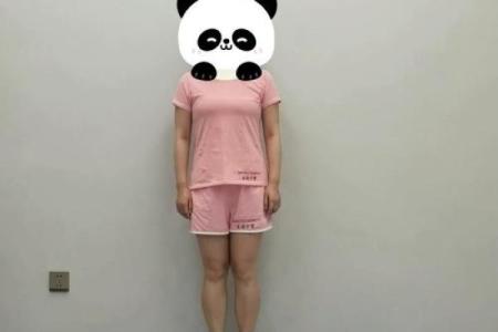 怎样纠正内八字,14岁内八字怎么矫正最快