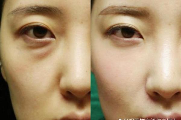 八字纹填充 八字纹填充