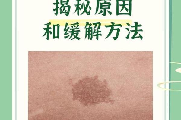 背部胎记算命，背部有胎记会怎样