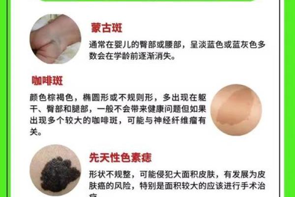背部胎记算命，背部有胎记会怎样